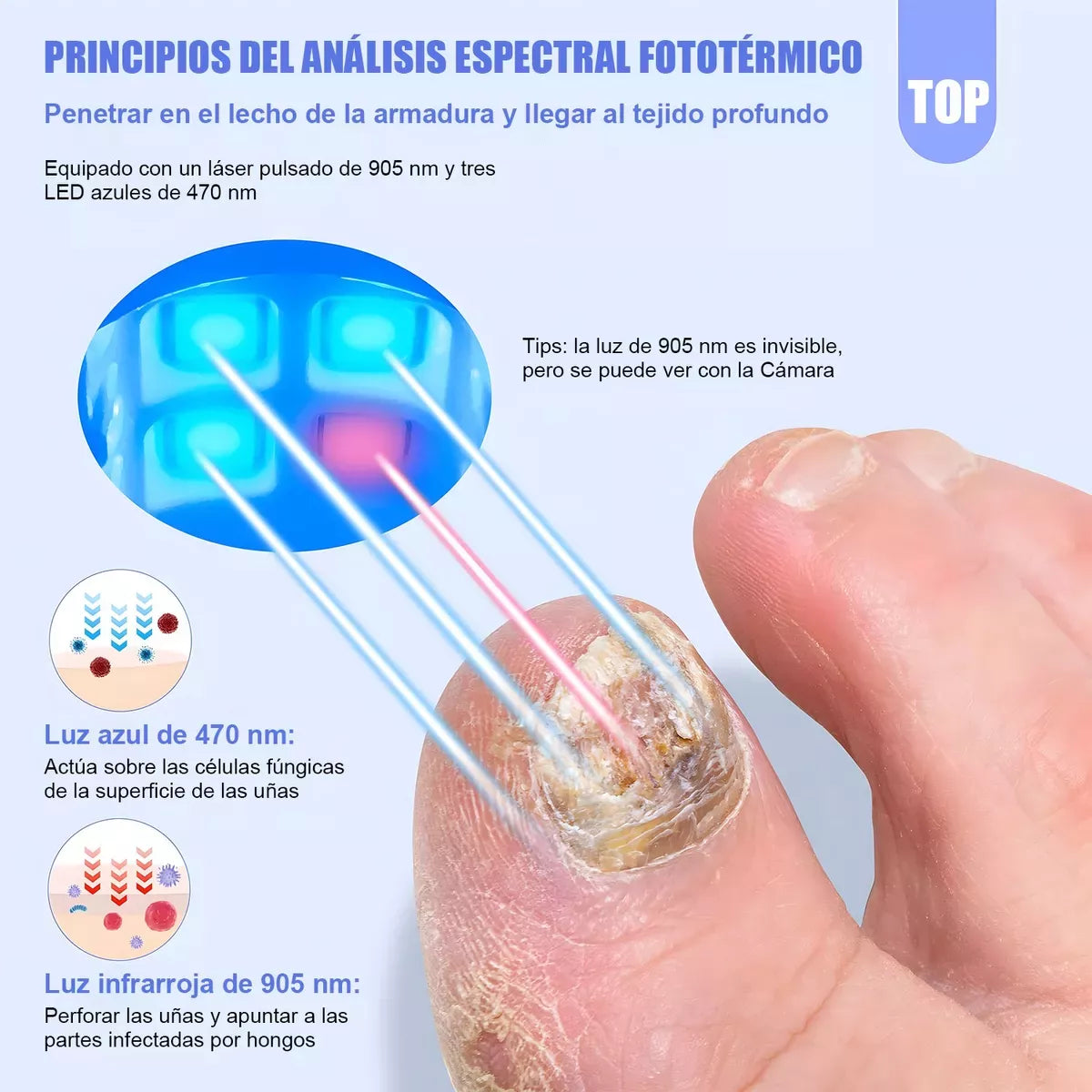 LumiNail®️|Adiós al Hongo: Tratamiento Láser para Uñas