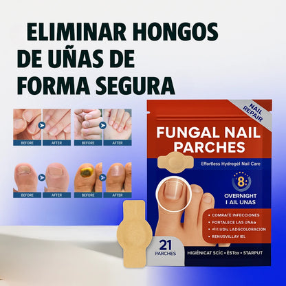 CuraNail®️|Parches para uñas