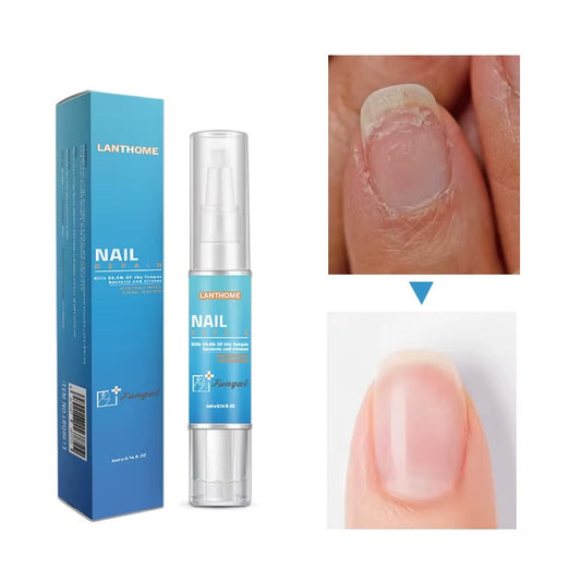 NAIL®️